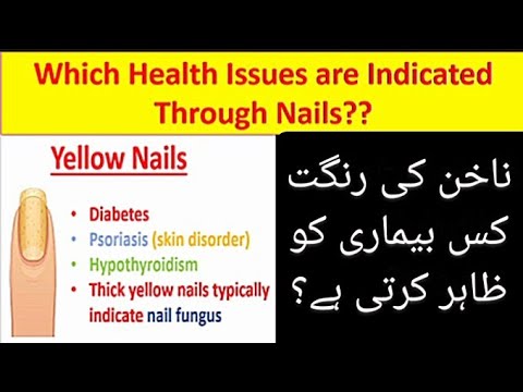 Which Health Issues are Indicated Through Nails? | Diseases | World of Biological Science