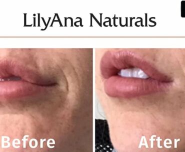 LilyAna Naturals Retinol Cream for Face /Amazon Beauty Products