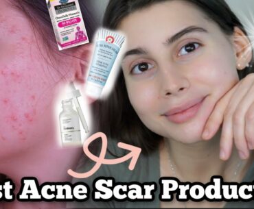 BEST SKINCARE ROUTINE FOR ACNE SCAR PRONE / DRY SENSITIVE SKIN DURING WINTER!!!!