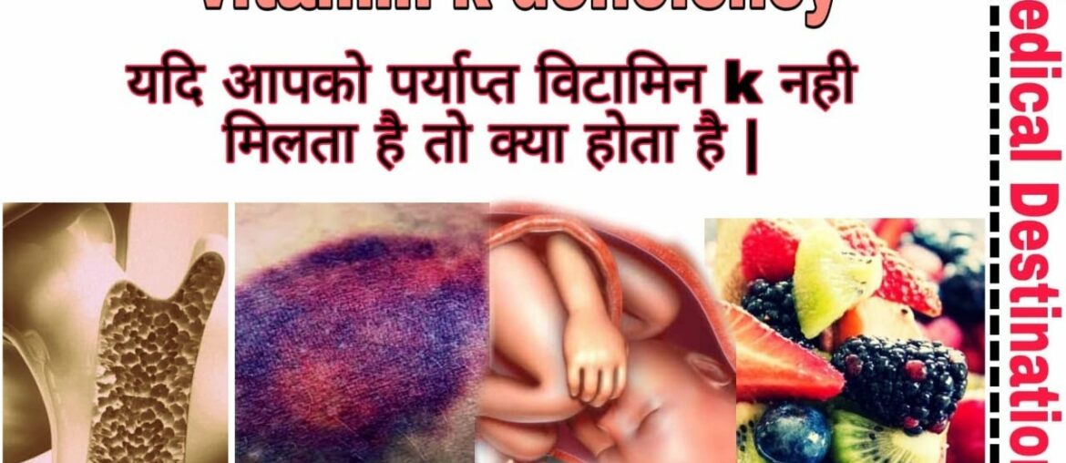 Vitamin-k deficiency|causes|symptoms and diet in hindi | Medical destination |