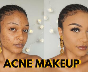 Cover acne and dark spots | Get flawless skin | Makeup Transformation