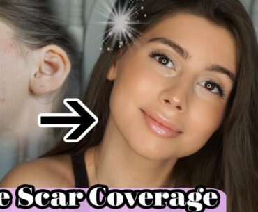 ACNE SCAR COVERAGE BOMBSHELL NATURAL MAKEUP LOOK!! || Look Your Best With Acne Scars!