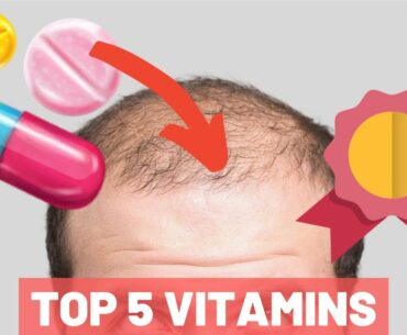 Top 5 Vitamins For Hair Growth - THE HOLY 5 YOU MUST NEED