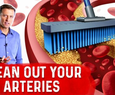 The Best Foods to Clean Out Your Arteries