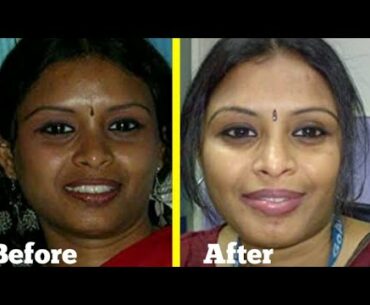 Fair skin face cream | AYUNEEM BEAUTY CREAM | Spotless skin | Skin care | Beauty | Brijwasi Girl