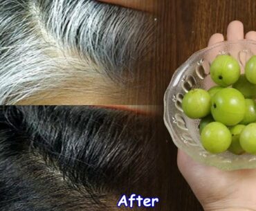Apply it 7 Night - White Hair To Black Hair Naturally in Just 8 Minutes Permanently ! 100% Works