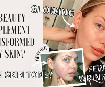 I Tried A Skin & Gut Beauty Supplement for 30 Days | BEFORE & AFTER Aura Inner Beauty Radiance