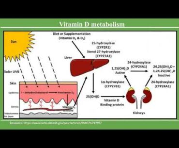 Vitamin D COVID-19 and Its Severity