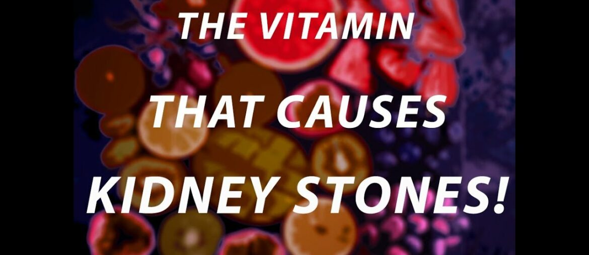 Too much of this vitamin can lead to kidney stones!