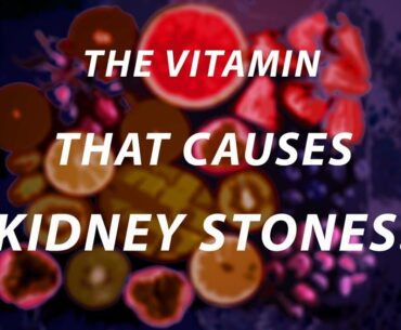 Too much of this vitamin can lead to kidney stones!