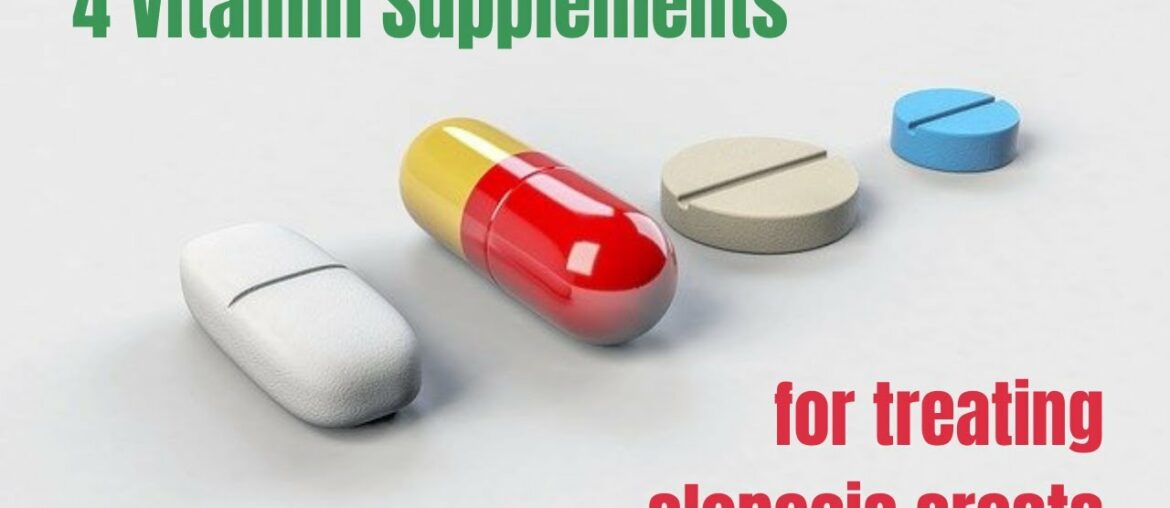 4 vitamin supplements to help treat alopecia areata