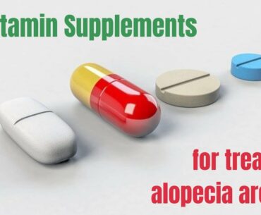 4 vitamin supplements to help treat alopecia areata