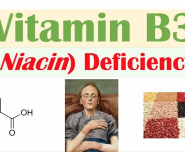 Vitamin B3 Niacin Deficiency (Pellagra) | Sources, Causes, Symptoms, Diagnosis, Treatment