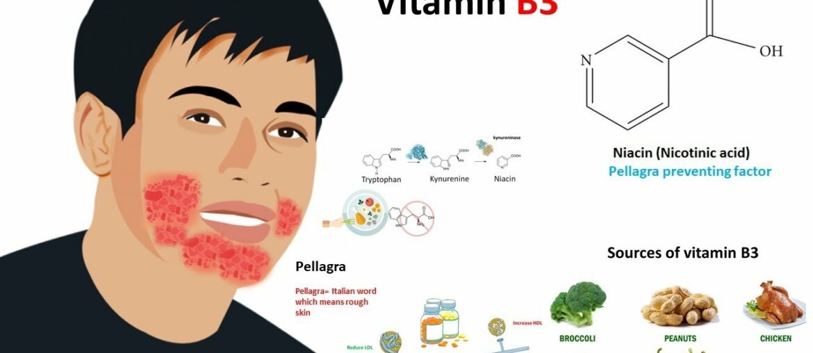 Vitamin B3 : Niacin (sources,metabolism and deficiency)