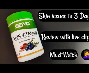 Oziva Skin Vitamins | 20 Days Experience with Live Clips | Severe Skin Issues in 3 days | Must Watch