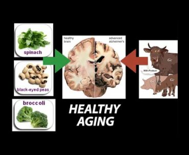 Healthy, (Nutrient) Wealthy and Wise: Diet for Healthy Aging - Research on Aging