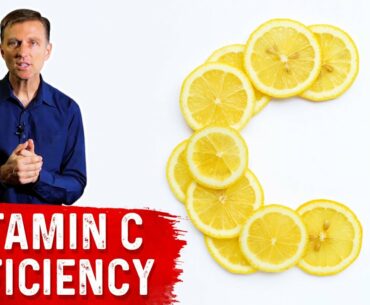 Eighty-two Percent of COVID-19 Patients Were Deficient in Vitamin C