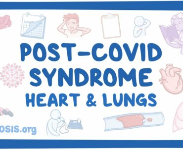 Post-COVID syndrome: Heart and lungs