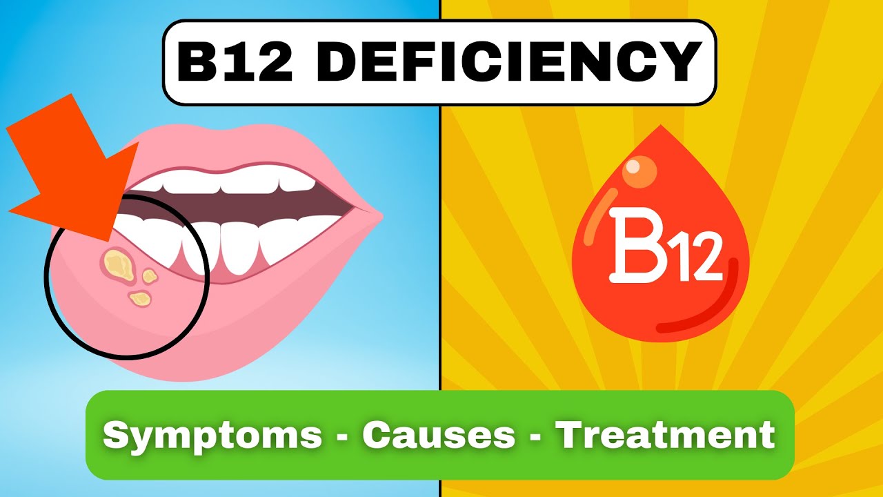 Vitamin B12 Deficiency Symptoms, Causes and How To Prevent It